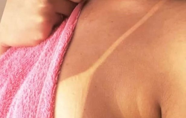 Bronzeamento Artificial ou Natural - Bronzeamento Perfeito